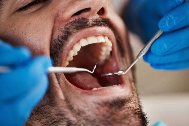 Best Pediatric Emergency Dentist in Shingle Springs, CA