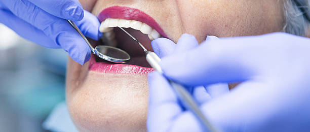 Best Weekend Emergency Dentist in Shingle Springs, CA